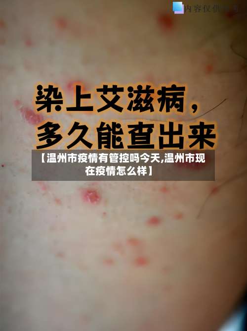 【温州市疫情有管控吗今天,温州市现在疫情怎么样】-第3张图片